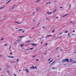 Tissue dense connective irregular histology howmed other include types