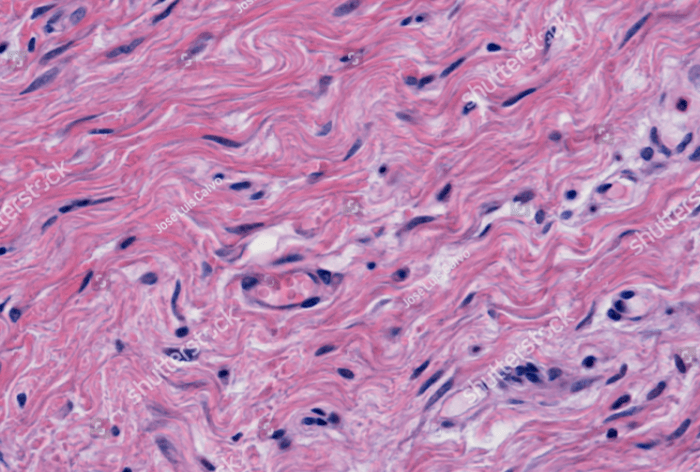 Tissue dense connective irregular histology howmed other include types