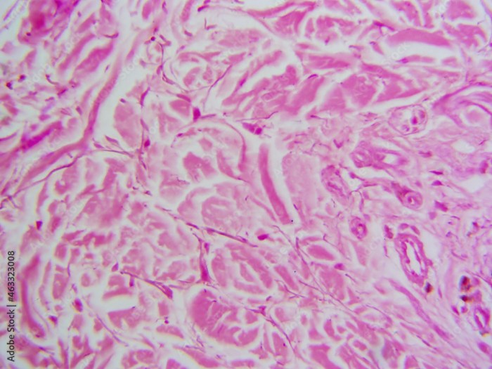 Dense irregular connective tissue microscope